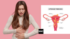 Uterine-Fibroids_Symptoms_Causes_When_to_Worry_NaturalWomenCare